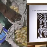 Pour financer ses soins : elle avale 100 boulettes de cocaïne